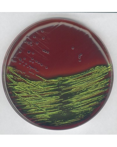 EMB agar for the detection and isolation of pathogenic Enterobacteriaceae-500g